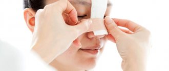 Rehabilitation after septoplasty