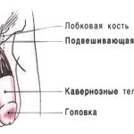 ligamentotomy scheme