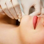 Sugaring of the face for women