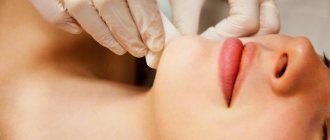 Sugaring of the face for women
