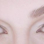 Трансплантация бровей