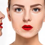 Удачные и неудачные фото круговой подтяжки лица до и после операции