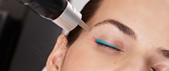 Удаление татуажа глаз лазером с век. Фото до и после, последствия