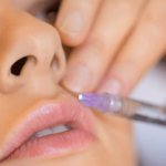 удалить биополимер из губ