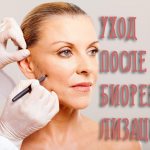 Уход после биоревитализации кожи лица – советы и запреты