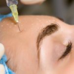 Витамины в ампулах для лица А, С, Е, F. Глицерин для кожи, от морщин, прыщей. Применение капсул Аевит, Либридерм