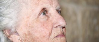 возрастные пигментные пятна на лице причины и лечение