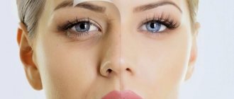 Впадины под глазами у женщины