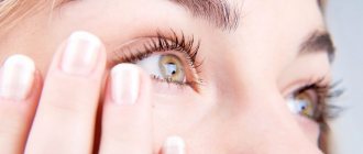 Yellow spots under the eyes: cause