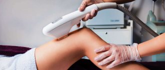 Зоны бикини Элос-эпиляция