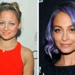 stars who have undergone plastic surgery