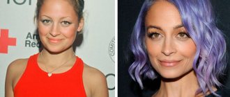 stars who have undergone plastic surgery